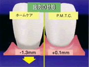 PMTC �����̏��