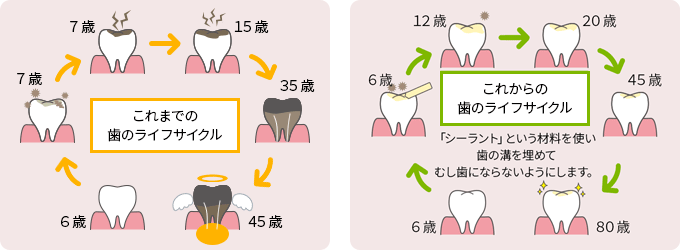 治療ではなく予防