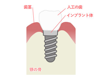 【1】健康な状態