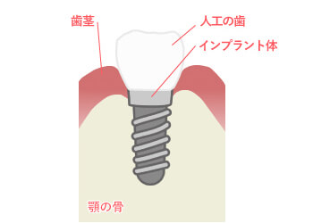 【1】健康な状態