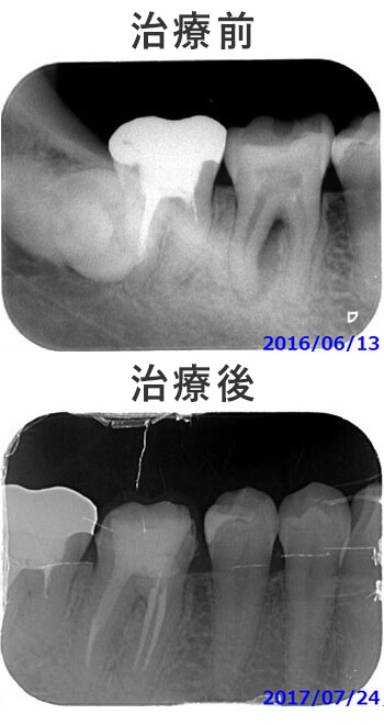 症例画像8