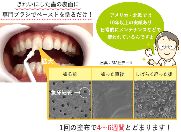 ホワイトバーニッシュFってどんなもの？